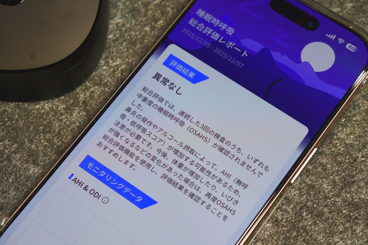 レポートとしても提示してくれる