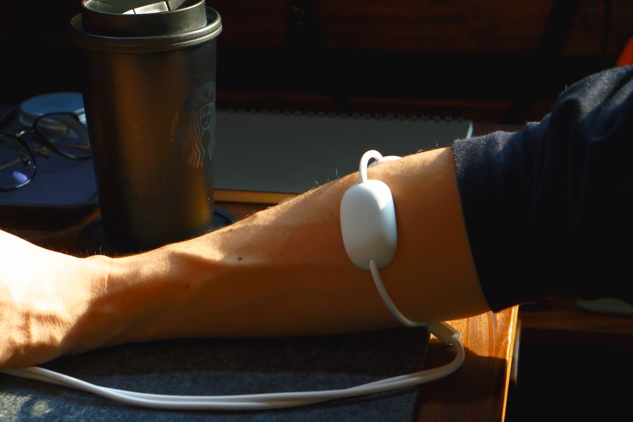 上腕をほぐしている写真